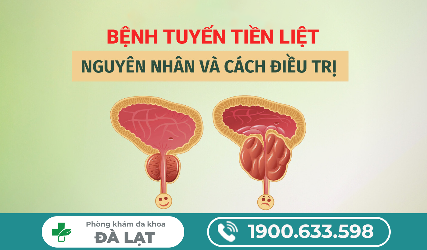 Hình ảnh minh họa